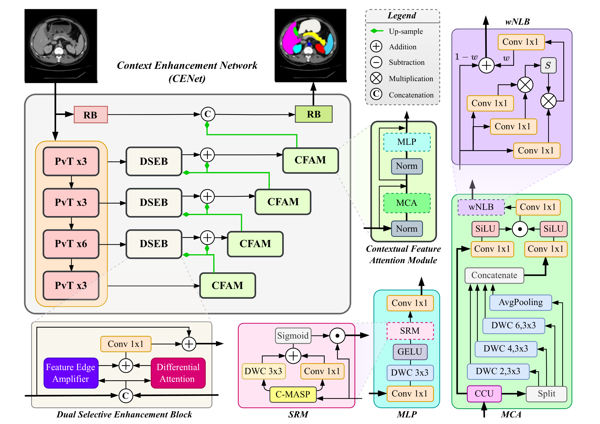 CENet architecture