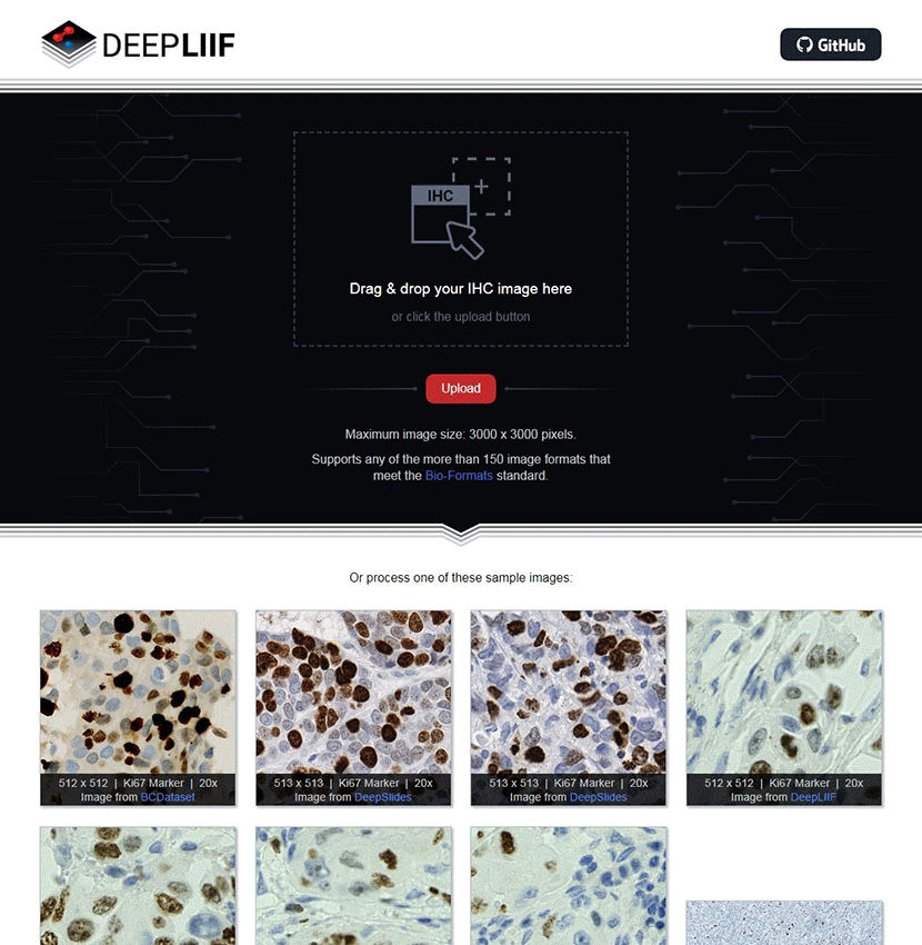 DeepLIIF Website Demo