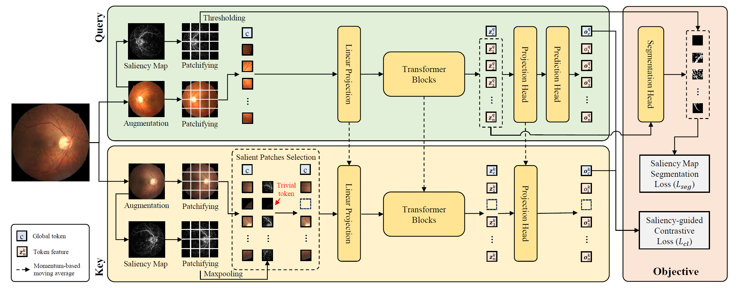 diabetic-retinopathy-grading-ai