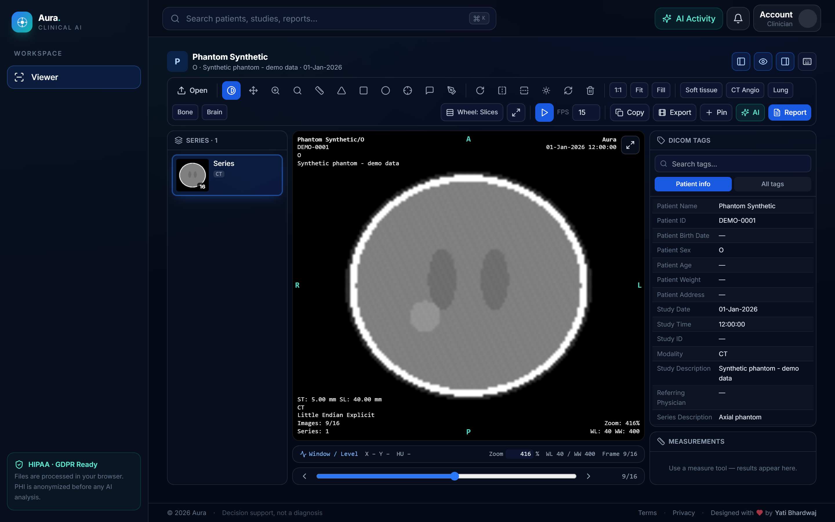 Aura viewing a CT study