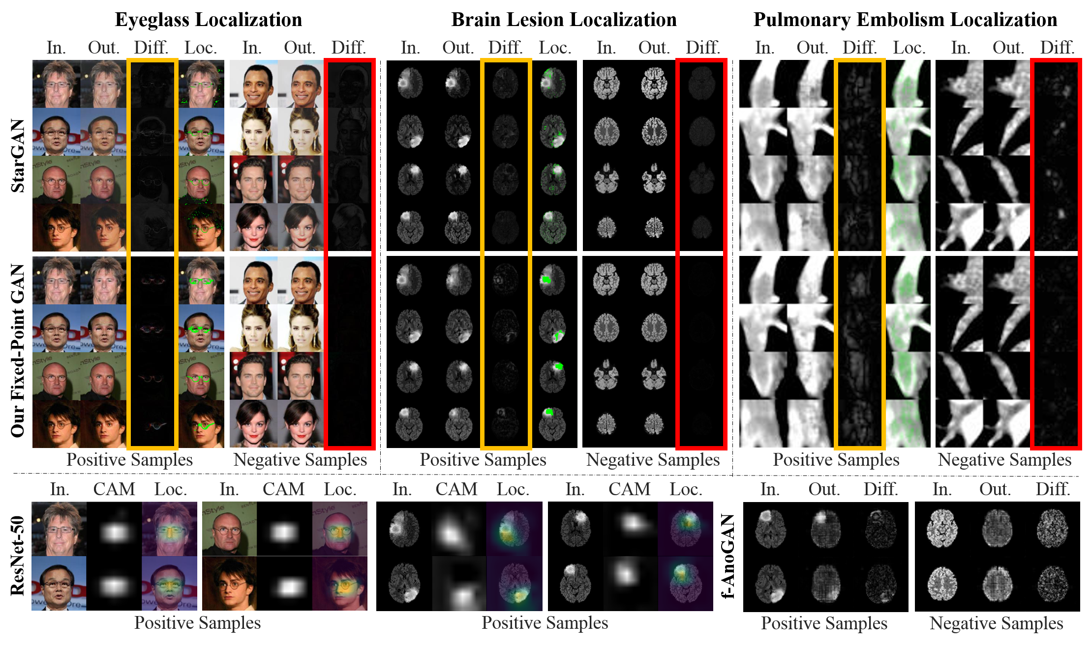 Example of disease detection and localization