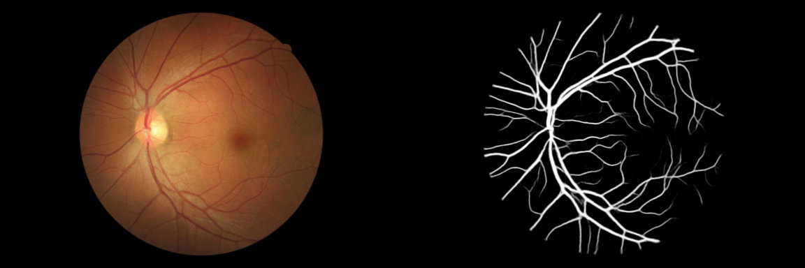 Segmentation Result