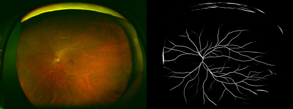 Segmentation Result