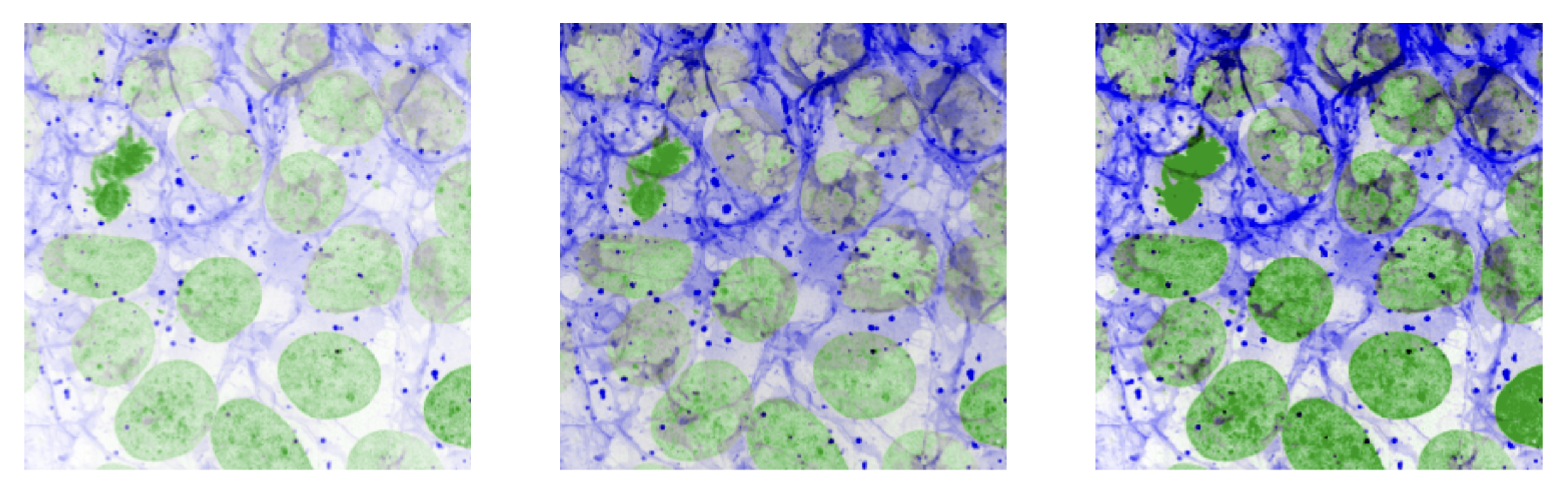 adjust the brightness with explicit of percentile based approaches