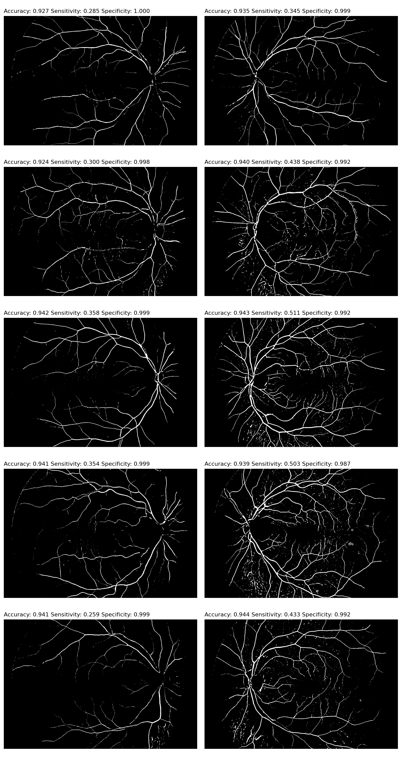 Preprocessed images