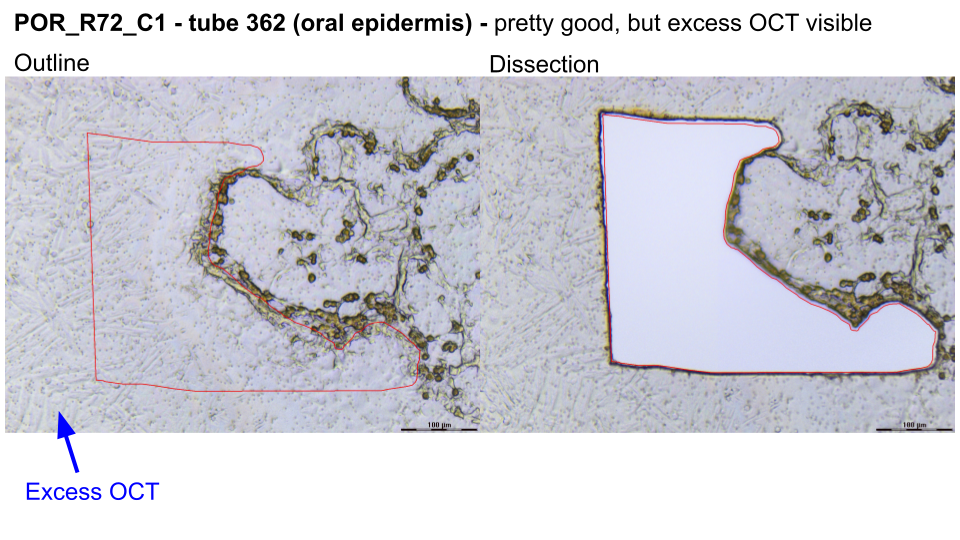 Example_2