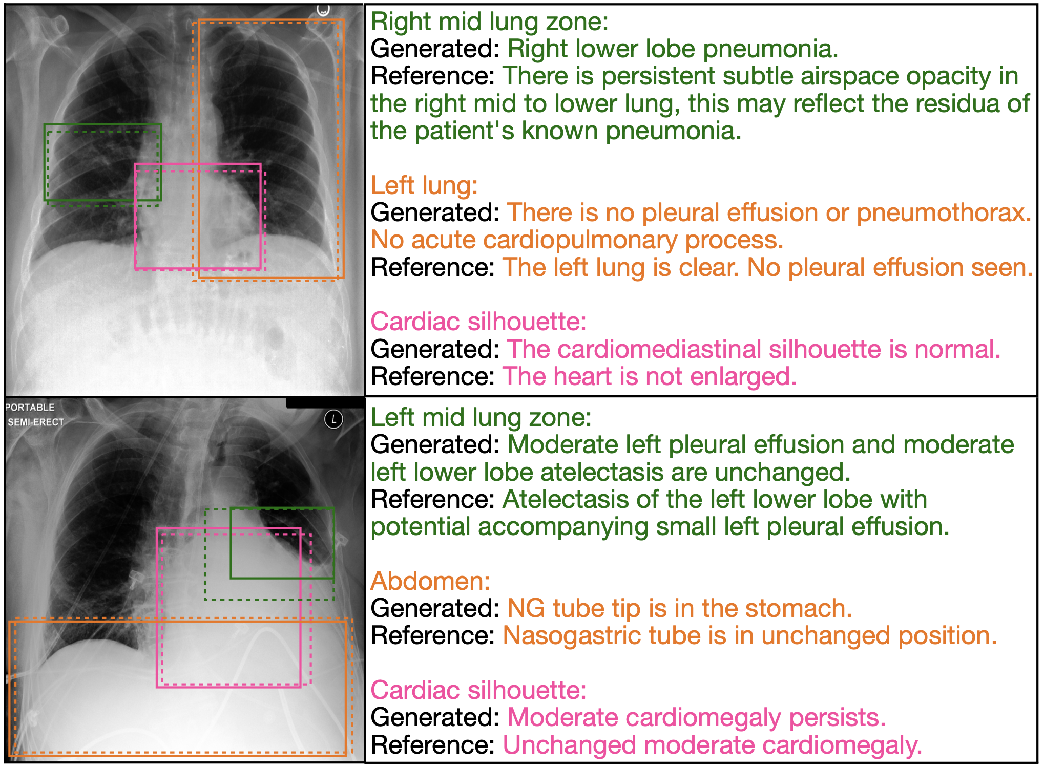 Anatomy-based generation