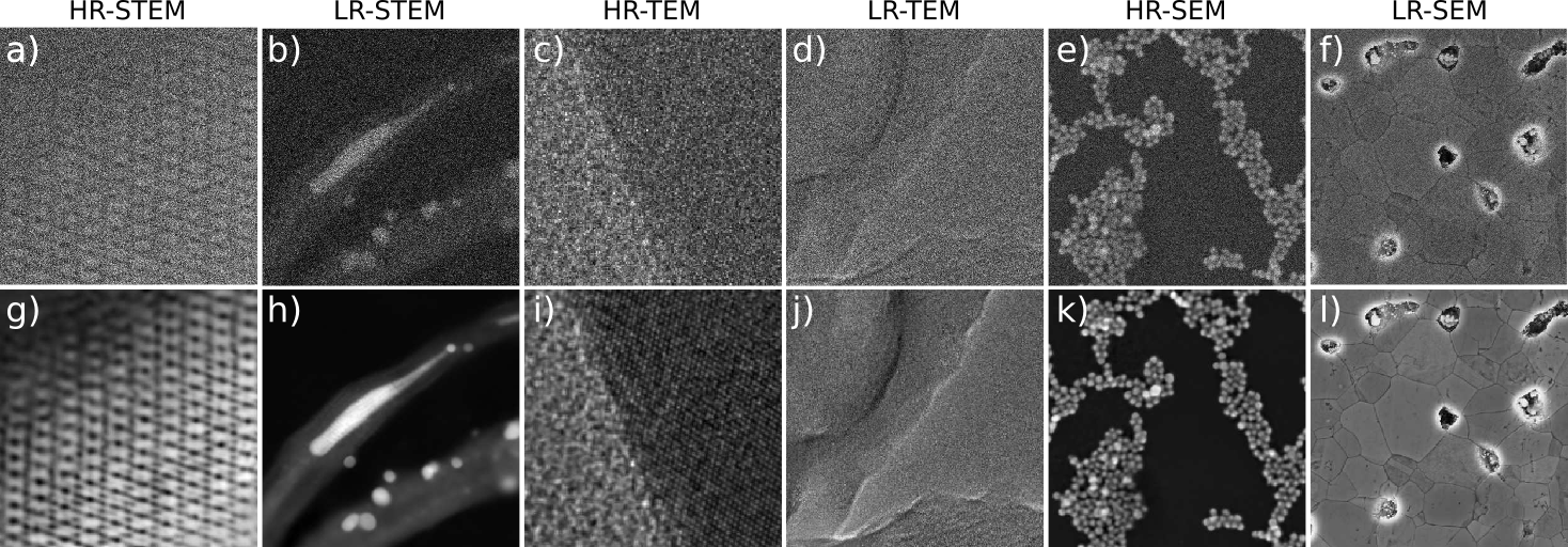 Experimental image restoration for various microscopy modalities. The top row illustrates the raw experimental images, while the bottom row displays the restored versions