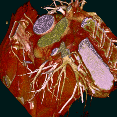 picture: Volume Render of Cardiac