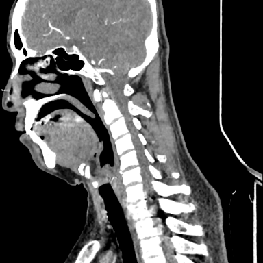 picture: Sagittal