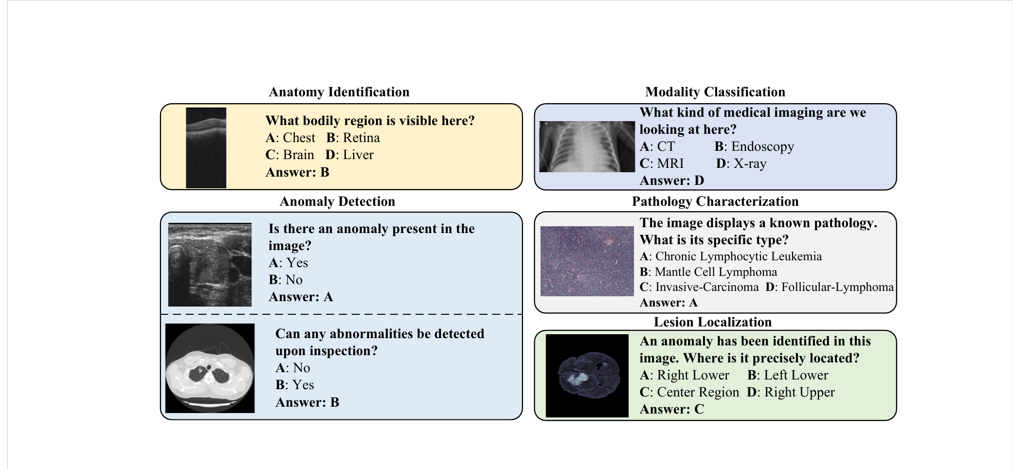 Examples of MedAD-38K VQA tasks