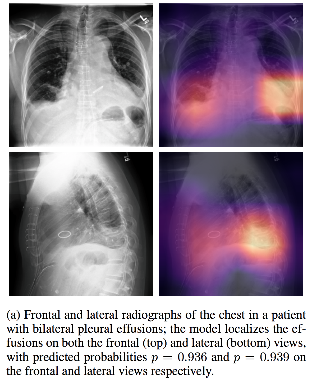 chestxpert